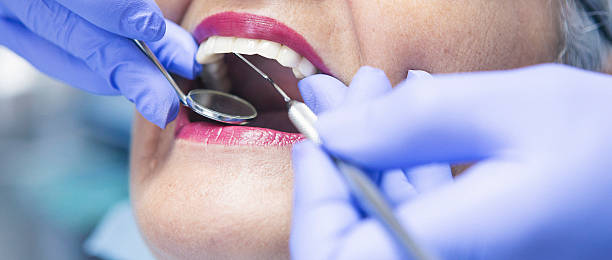 Best Knocked-Out Tooth Emergency  in Cottonwood Shores, TX